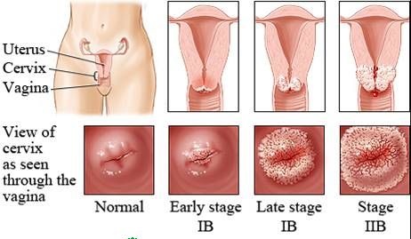 7. Những Lưu Ý Khi Chăm Sóc Bệnh Nhân