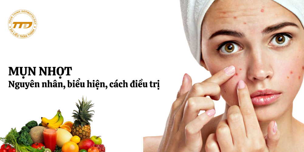 nguyên nhân, biểu hiện, cách điều trị mụn nhọt