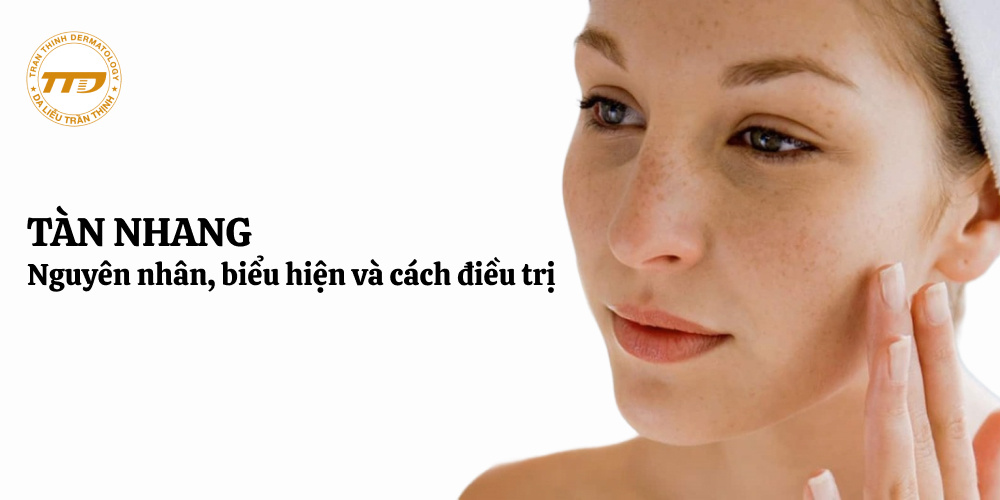nguyên nhân, biểu hiện, điều trị tàn nhang