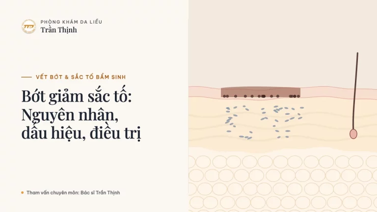 Bớt giảm sắc tố: Nguyên nhân, dấu hiệu, điều trị