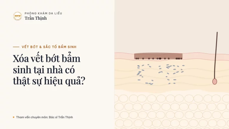Xóa vết bớt bẩm sinh tại nhà có thật sự hiệu quả?