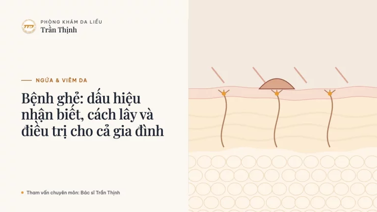Bệnh ghẻ: dấu hiệu nhận biết, cách lây và điều trị cho cả gia đình