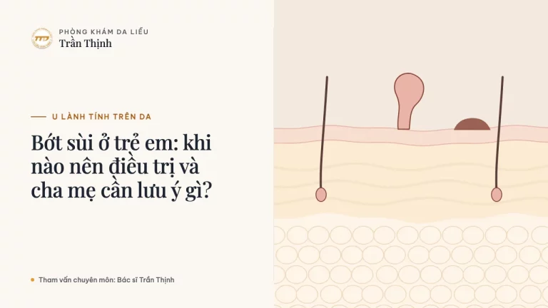 Bớt sùi ở trẻ em: khi nào nên điều trị và cha mẹ cần lưu ý gì?