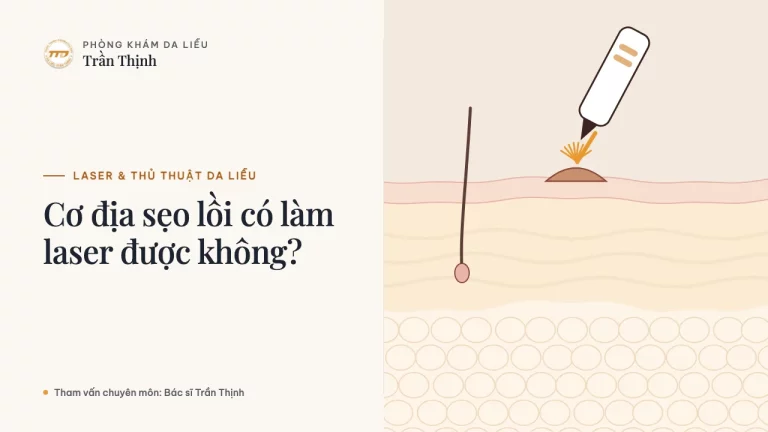 Cơ địa sẹo lồi có làm laser được không?