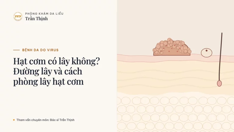 Hạt cơm có lây không? Đường lây và cách phòng lây hạt cơm