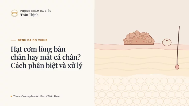 Hạt cơm lòng bàn chân hay mắt cá chân? Cách phân biệt và xử lý