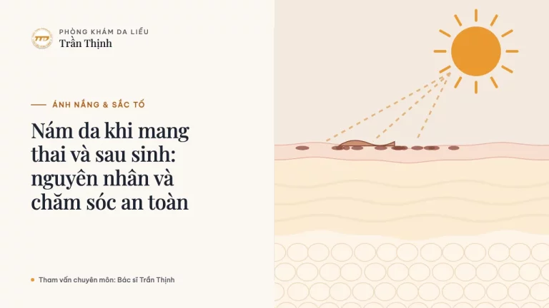 Nám da khi mang thai và sau sinh: nguyên nhân và chăm sóc an toàn