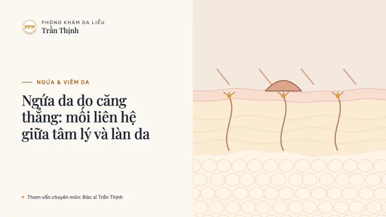 Ngứa da do căng thẳng: mối liên hệ giữa tâm lý và làn da