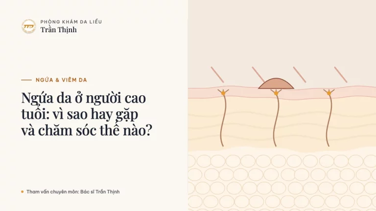 Ngứa da ở người cao tuổi: vì sao hay gặp và chăm sóc thế nào?