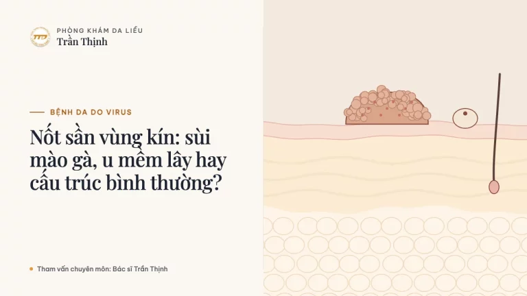 Nốt sần vùng kín: sùi mào gà, u mềm lây hay cấu trúc bình thường?