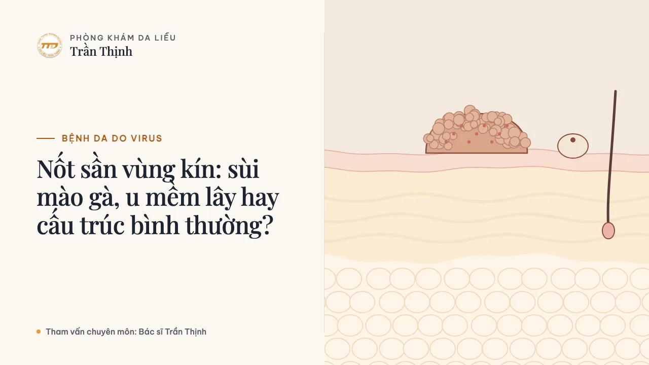 Minh họa: Nốt sần vùng kín: sùi mào gà, u mềm lây hay cấu trúc bình thường?