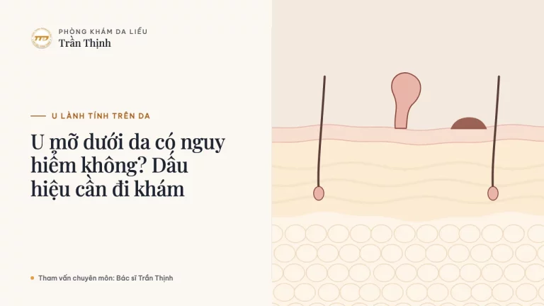 U mỡ dưới da có nguy hiểm không? Dấu hiệu cần đi khám